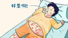 牛皮癣需求留心什么