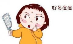 天津治疗青春痘哪家好