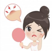 天津治青春痘医院哪家比较好